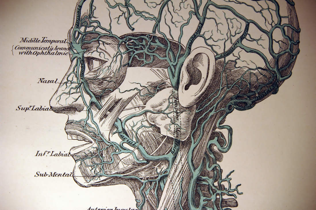 Schéma médical de la tête et des vaisseaux sanguins.